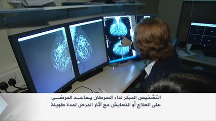 السرطان.. من مرض قاتل إلى مزمن