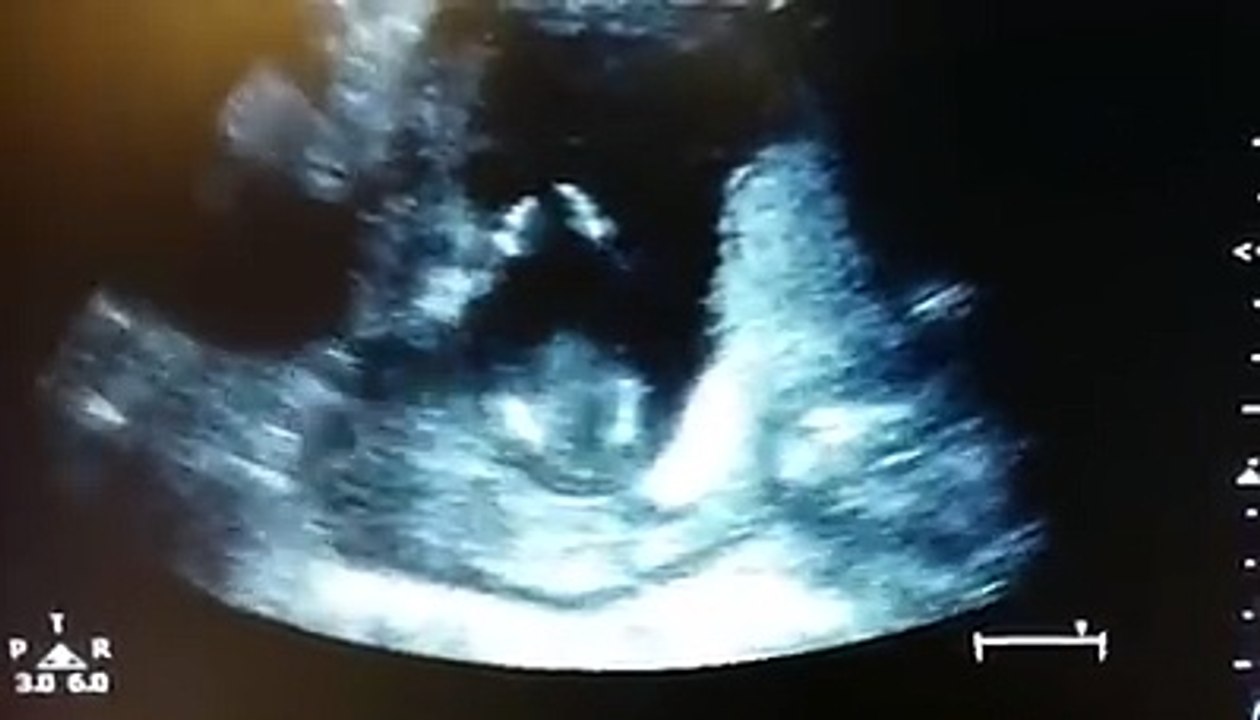 A child in the womb claps hands when hearing a melody sang by parents