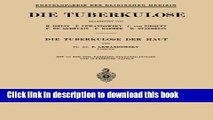 [Popular Books] Die Tuberkulose der Haut (Enzyklopaedie der Klinischen Medizin) (German Edition)