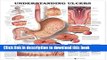 [PDF] Understanding Ulcers Anatomical Chart Free Online