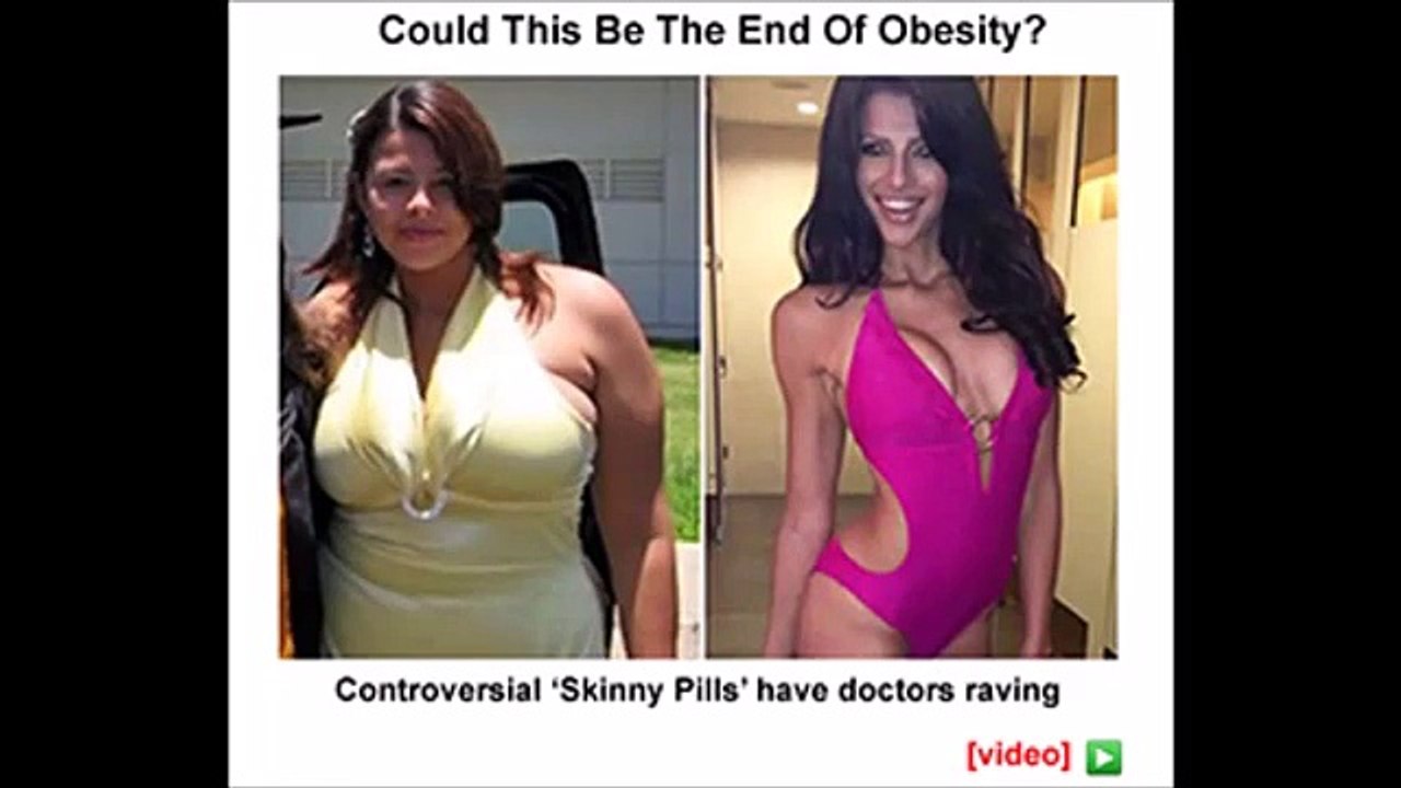 White Kidney Bean Extract | Does White Kidney Bean Extract Works? Truth Inside!