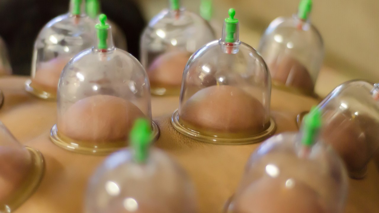 What The Hell is Cupping?