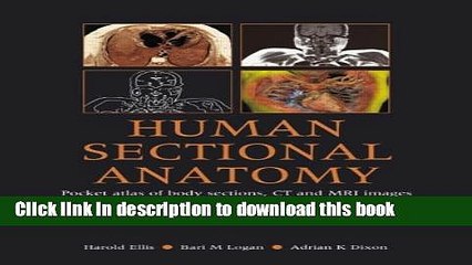 [Download] Human Sectional Anatomy: Pocket Atlas of Body Sections, CT and MRI Images, Third