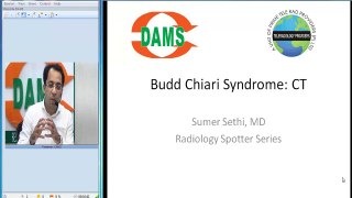 Radiology Spotters 28 - Budd Chiari Syndrome: CT by Dr. Sumer Sethi