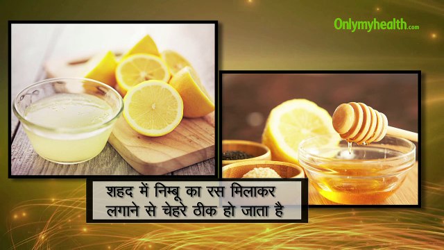 इन घरेलू नुस्खे से दूर करें चेहरे के दाग-धब्बे व झाइयां