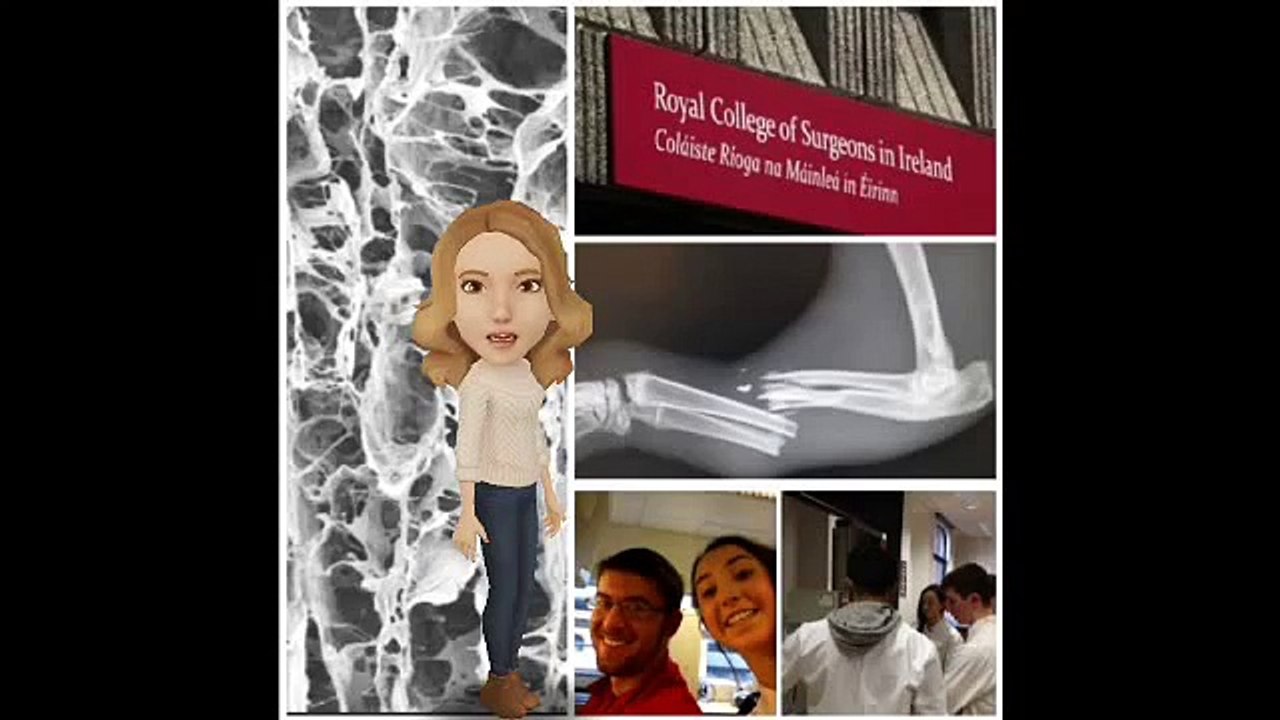 RCSI