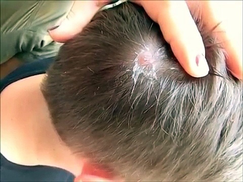 Il revient de voyage et sent quelque chose bouger dans sa tête! Ce que sa femme retire? OH MON DIEU!