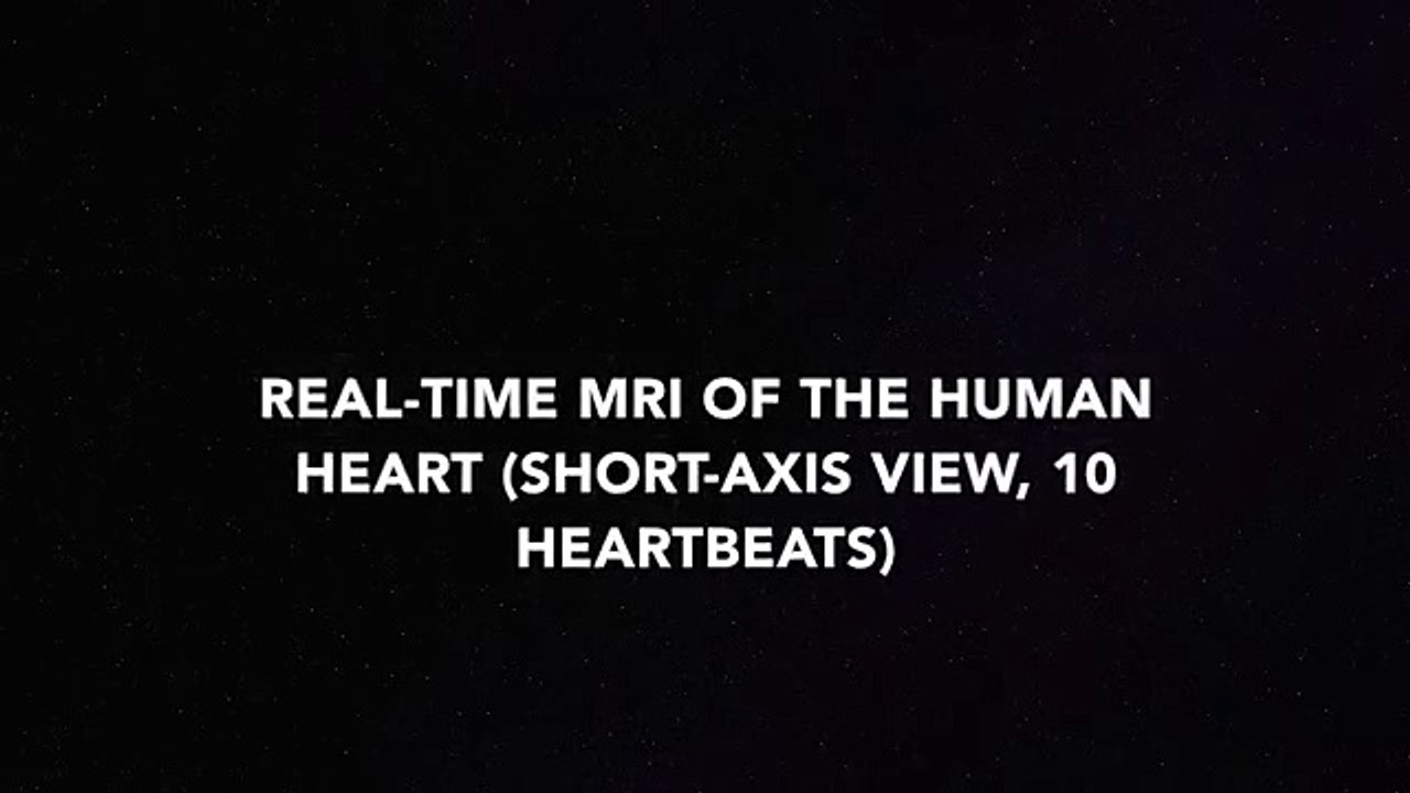 Real-time MRIs of the Human Heart