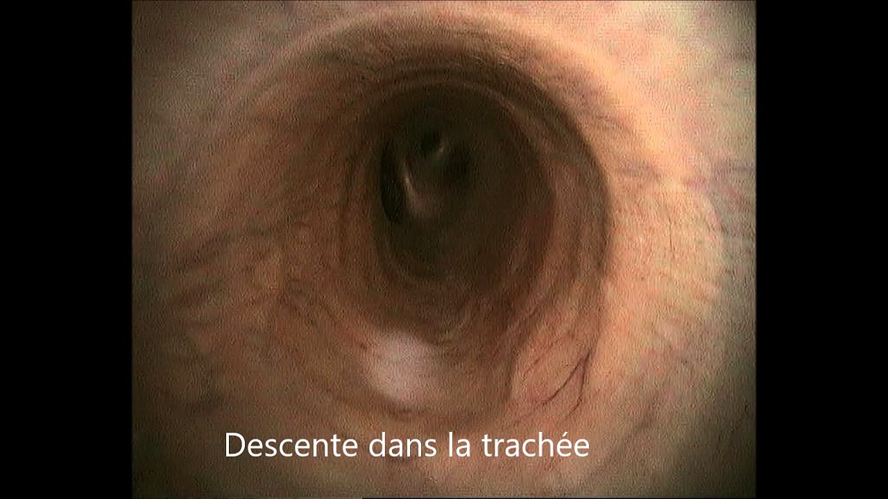 Lavage broncho-alvéolaire chez un cheval (LBA)