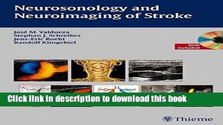 [Download] Neurosonology and Neuroimaging of Stroke Kindle Free