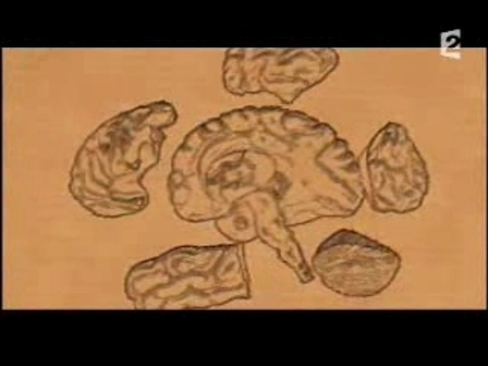 Rayons X - Sommeil paradoxal