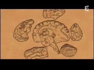 Rayons X - Sommeil paradoxal