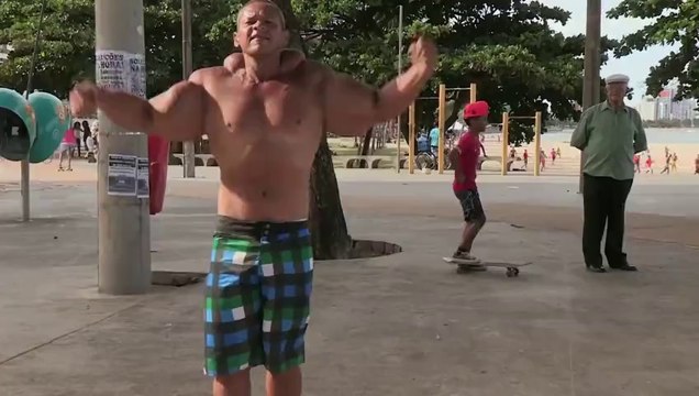 Un homme gonflé aux stéroïdes et aux injections de synthol