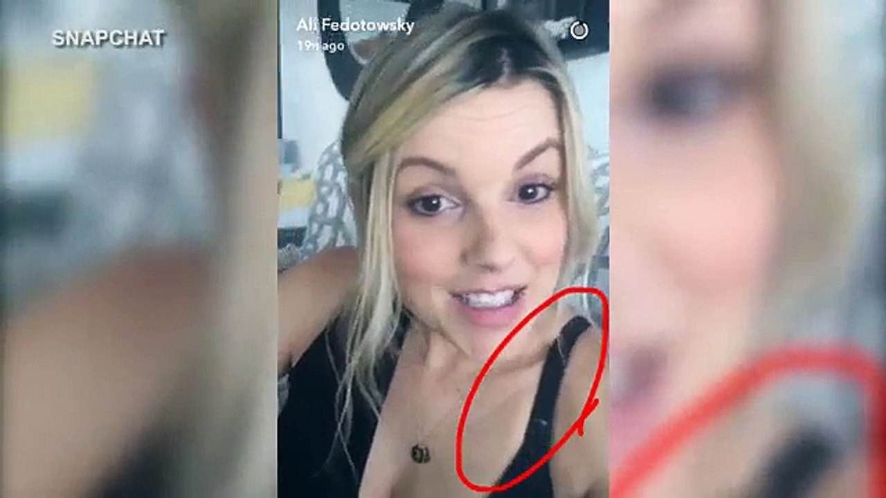 Ali Fedotowsky has wardrobe malfunction before wedding dress shopping