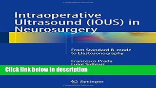 Download Intraoperative Ultrasound (IOUS) in Neurosurgery: From Standard B-mode to