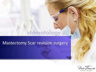 Mastectomy Scar revision surgery