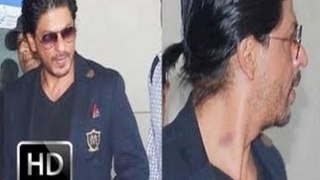 Spotted: SRK with love bite on his neck
