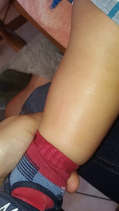 aloe vera apres