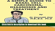 [Popular] A Simple Guide to Basal Cell Carcinoma, Diagnosis and Treatment (A Simple Guide to