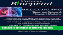 [Popular] Small Cell Lung Cancer - Treatment Options and Alternative Medicine Hardcover Online