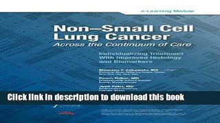 [Popular] Non-Small Cell Lung Cancer: Across the Continuum of Care Paperback Free