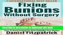 [Popular] Fixing Bunions Without Surgery: How To Avoid Ending Up With Feet Like Your Mother