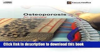 [Popular] Osteoporosis: An Overview Paperback Collection