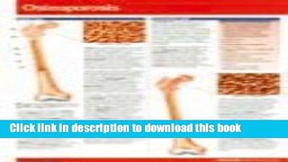 [Popular] Osteoporosis Paperback Collection