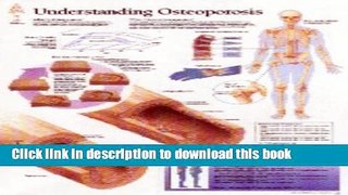[Popular] Understanding Osteoporosis chart: Wall Chart Paperback Collection