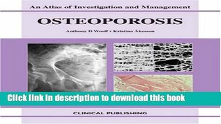[Popular] Osteoporosis (Atlas of Investigation and Management) Paperback Free