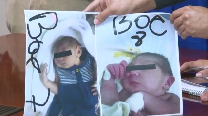 En aumento cifras de menores con microcefalia