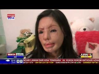Impian Lisa Face Off Sepulangnya dari Rumah Sakit