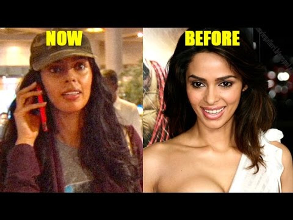 HOT Mallika Sherawat's Plastic Surgery Gone WRONG