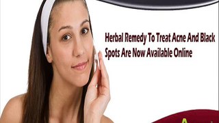 Herbal Remedy To Treat Acne And Black Spots Are Now Available Online