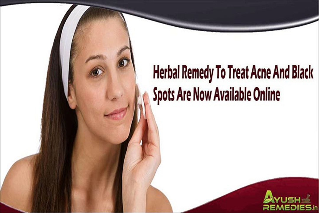 Herbal Remedy To Treat Acne And Black Spots Are Now Available Online