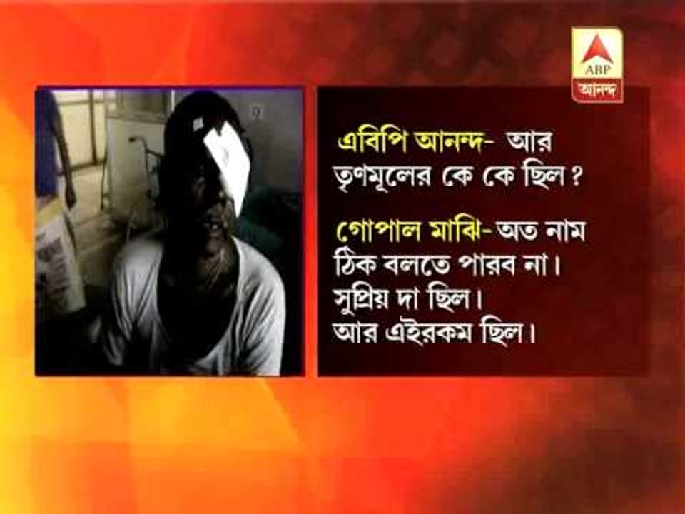 Hit in eye for skipping work.