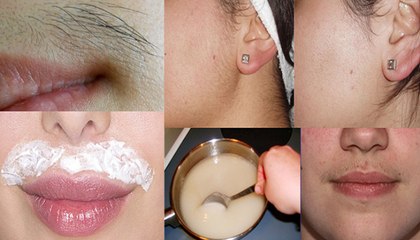 Remove Facial Hair Permanently With Magical Mask
