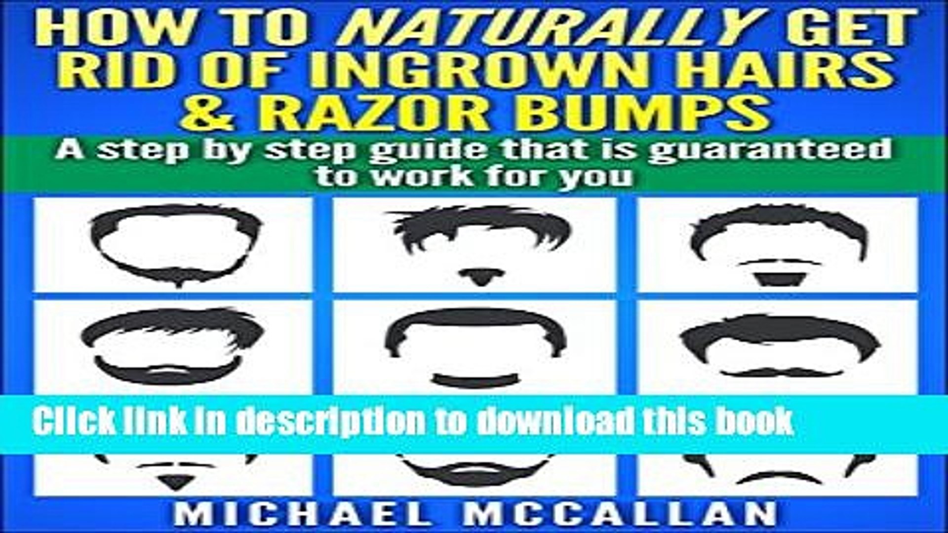 Download How To Naturally Get Rid Of Ingrown Hairs And Razor