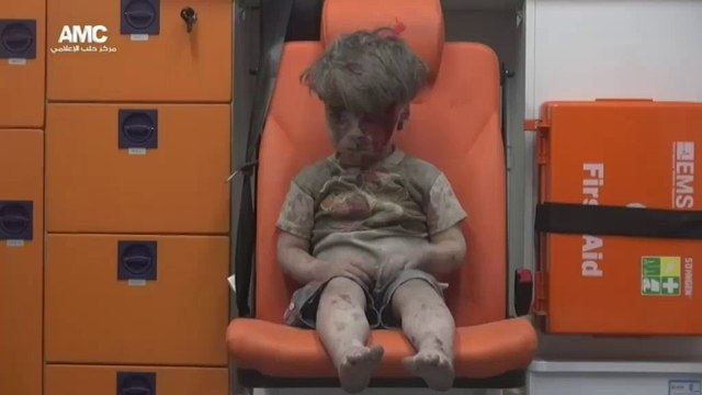 Suriye Halep'teki yaralı çocuğun bakışları dünyanın içine işledi!