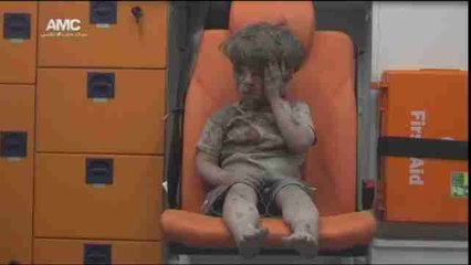 La imagen de un niño herido muestra el drama de los bombardeos en Siria