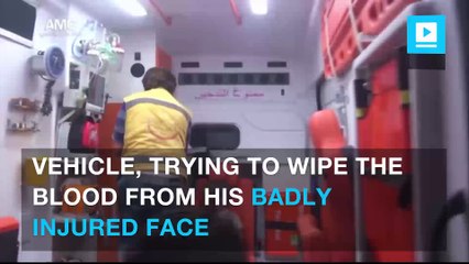 Heartbreaking photo of little boy is becoming Aleppo's​ symbol of suffering