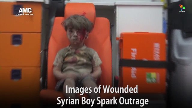 Images of Wounded Syrian Boy Sparks Outrage