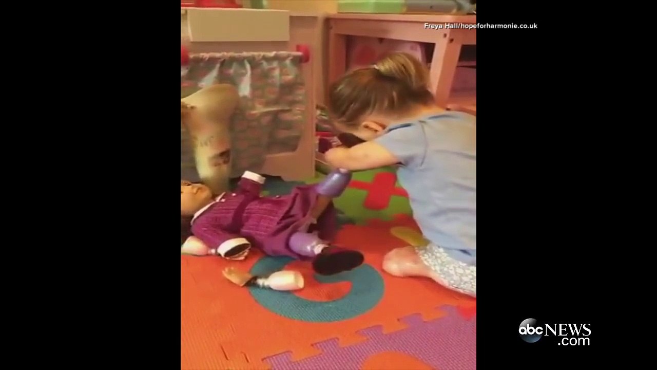 Cette petite a du être amputée pour avoir la vie sauve, mais attendez de voir sa poupée!