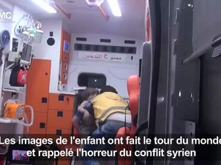 Omrane, 4 ans, symbole de la violence aveugle de la guerre en Syrie