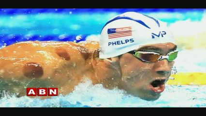 What Is Cupping Therapy | Reasons You Should Try Cupping Therapy