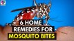 6 Home Remedies for Mosquito Bites - Health Sutra