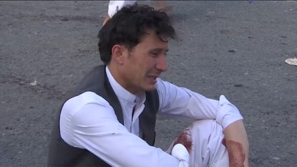 الضحايا الأفغان يخجلون من مراجعة الطبيب النفسي