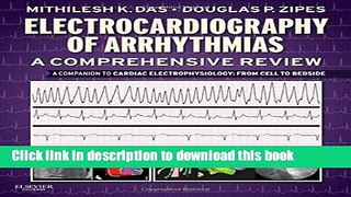 [PDF] Electrocardiography of Arrhythmias: A Comprehensive Review: A Companion to Cardiac