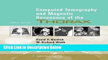 Books Computed Tomography and Magnetic Resonance of the Thorax Full Online