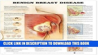 [READ] EBOOK Benign Breast Disease Anatomical Chart ONLINE COLLECTION